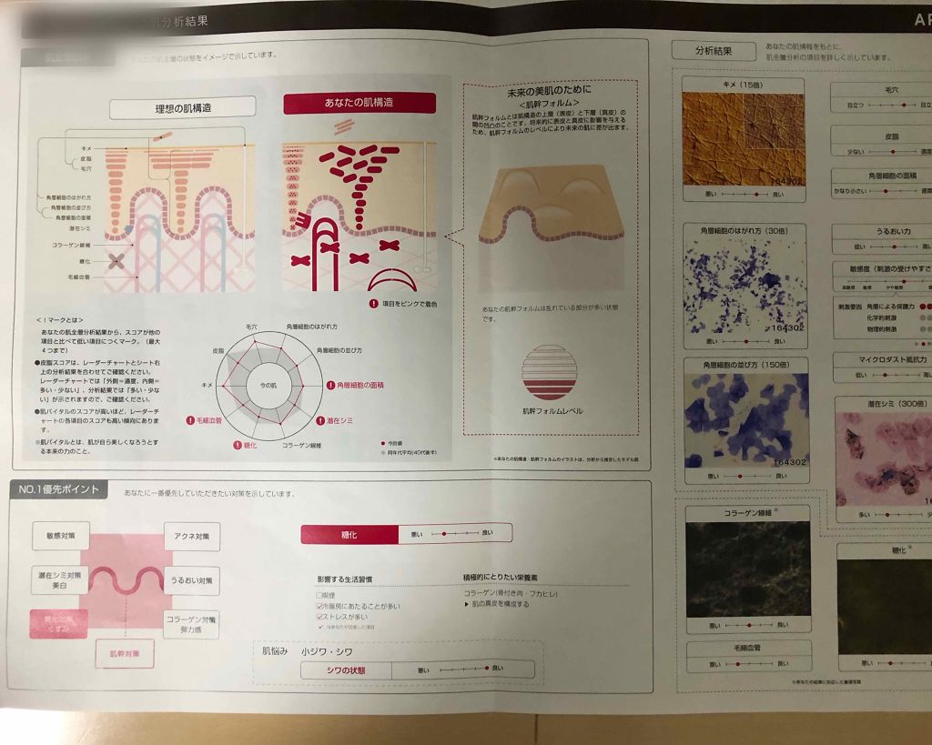 マンスリースキンケアプログラム(旧)/APEX/スキンケアキットを使ったクチコミ(1枚目)