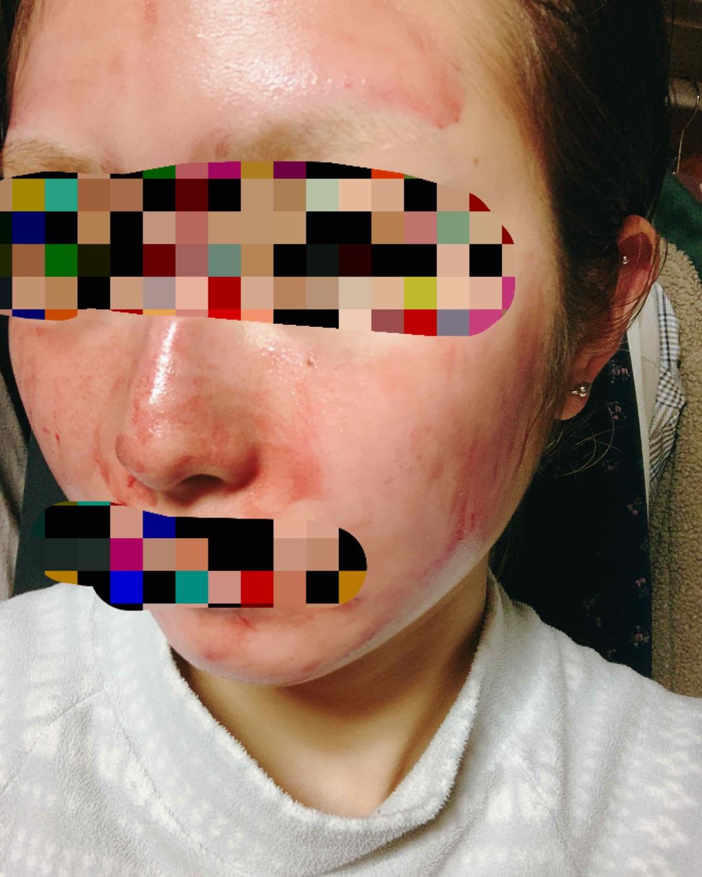 AHA 30% + BHA 2% Peeling Solution/The Ordinary/ピーリングを使ったクチコミ(3枚目)