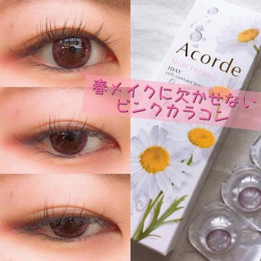 Acorde（アコルデ） フォーチュンピンク(シークレットグロウ)数量限定/Acorde/カラーコンタクトレンズを使ったクチコミ（1枚目）