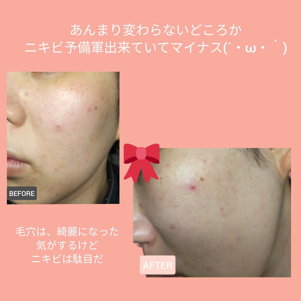 リサージ コラゲリードa/リサージ/美容液を使ったクチコミ（3枚目）