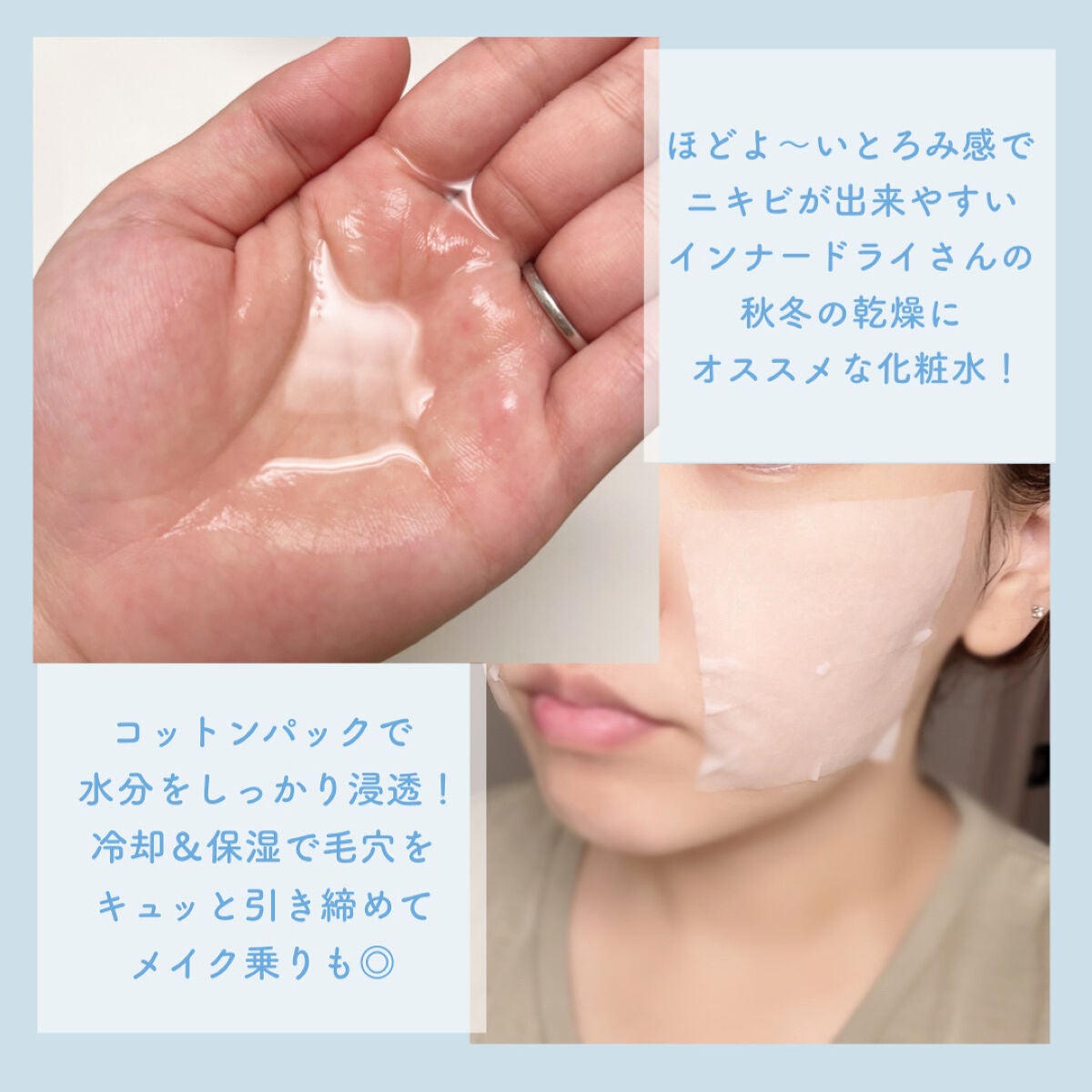 シラカバ 70% 水分ブースティングトナー/Anua/化粧水を使ったクチコミ(4枚目)