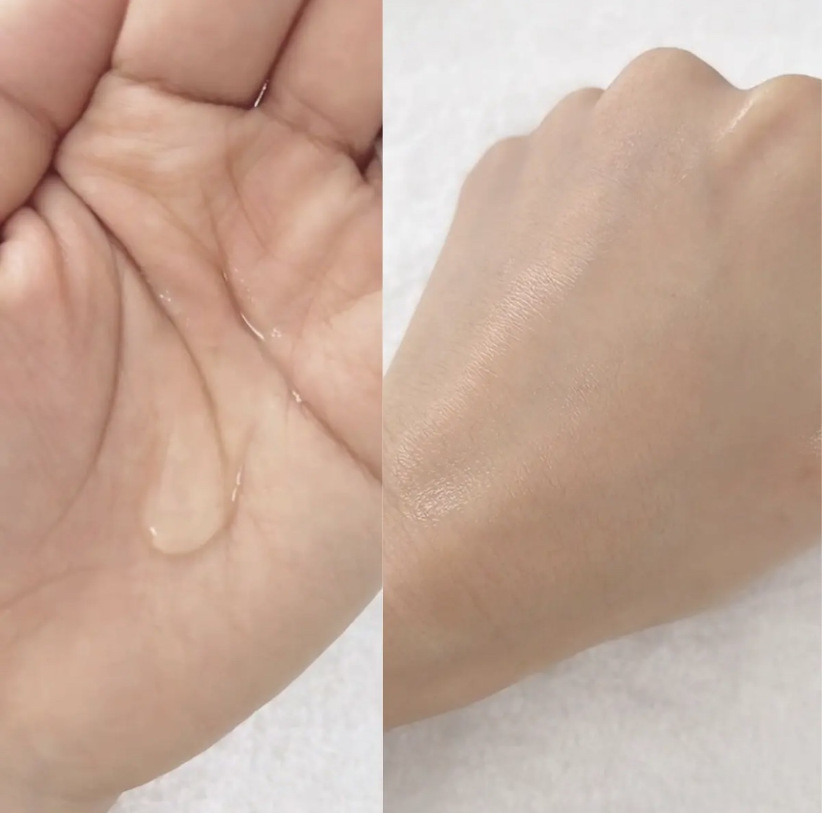 タカミスキンピール/タカミ/ブースター・導入液を使ったクチコミ（2枚目）