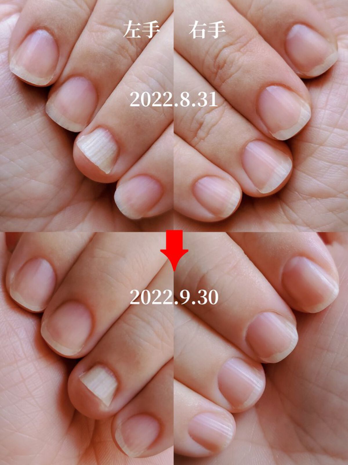 アンティセプト/LCN/ネイルオイル・トリートメントを使ったクチコミ（3枚目）