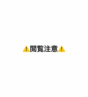 ⚠️⚠️⚠️閲覧・長文注意⚠️⚠️⚠️


私は2年前、突然大量発生したニキビに悩まされていました。

社会人になってから2年目までは、毎日のようにバッチリメイクをしていても生理前以外は特に荒れてはいな