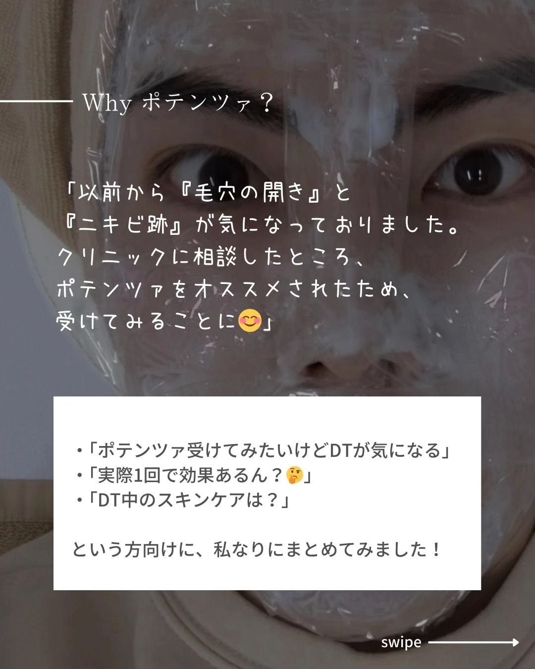 あき┃筋トレ美容家 on LIPS 「こんばんは、あきです!この前、人生初のポテンツァを受けてきまし..」(2枚目)