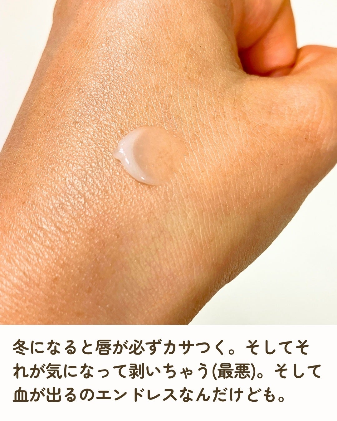 モアリップ N (医薬品)/資生堂薬品/その他を使ったクチコミ(2枚目)