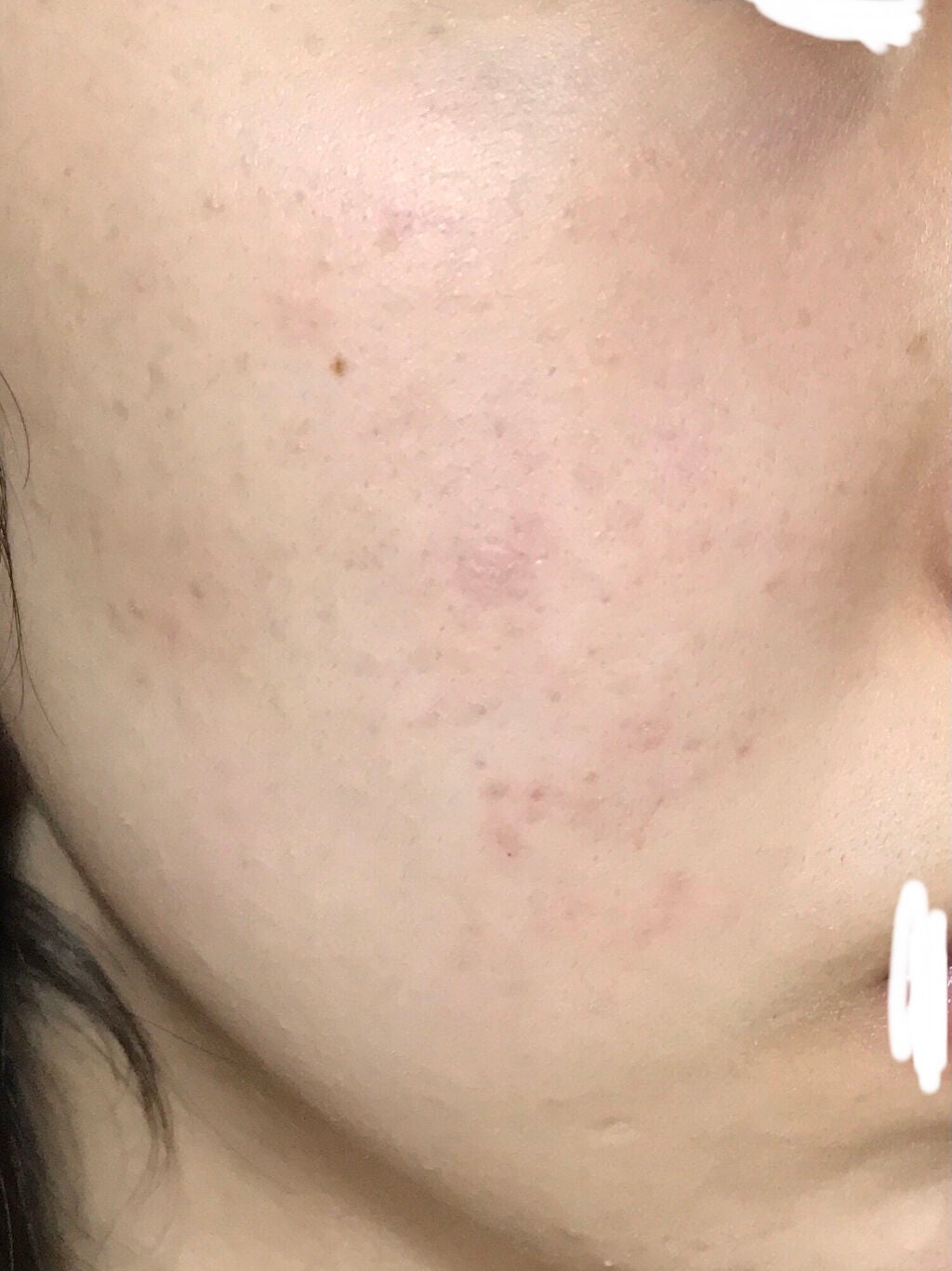 ðNinað on LIPS ãâ ïžæ±è泚æïŒâ ïžããã«ã¡ã¯ããã°ãã¯ïŒã¯ããæ³£ãããã§ããã..ãïŒ4æç®ïŒ