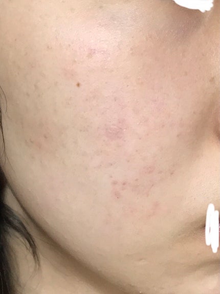 ðNinað on LIPS ãâ ïžæ±è泚æïŒâ ïžããã«ã¡ã¯ããã°ãã¯ïŒã¯ããæ³£ãããã§ããã..ãïŒ4æç®ïŒ