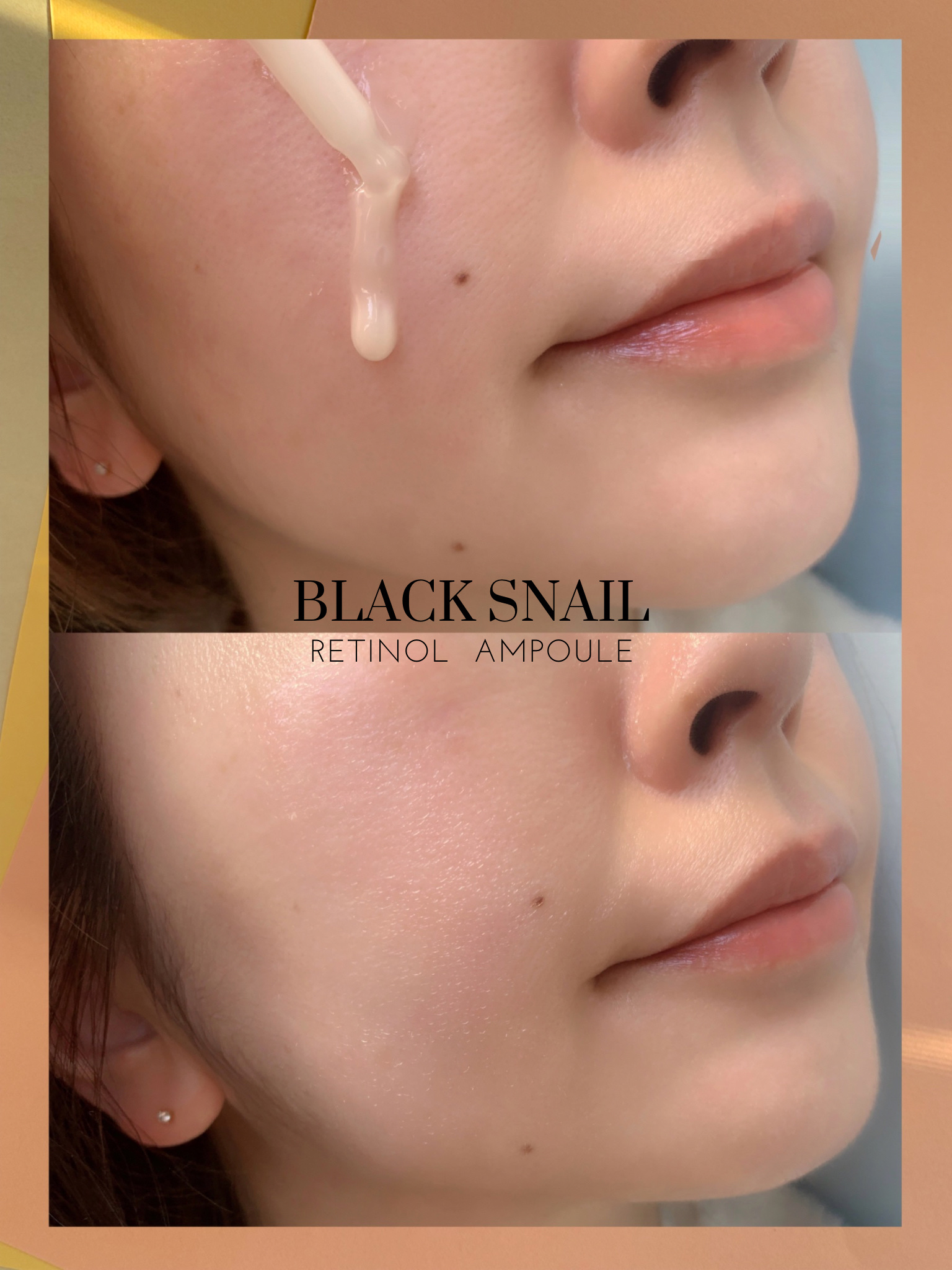 ブラックスネイルレチノールセラム/Dr.G/美容液を使ったクチコミ（3枚目）