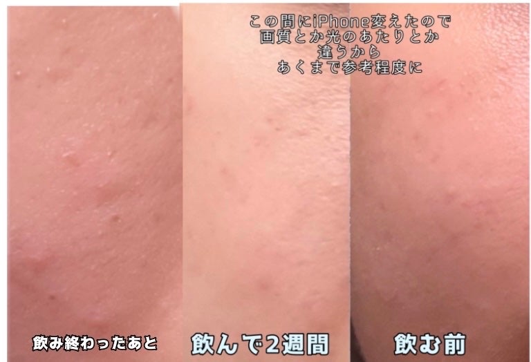 DHC はとむぎエキス/DHC/健康サプリメントを使ったクチコミ(3枚目)