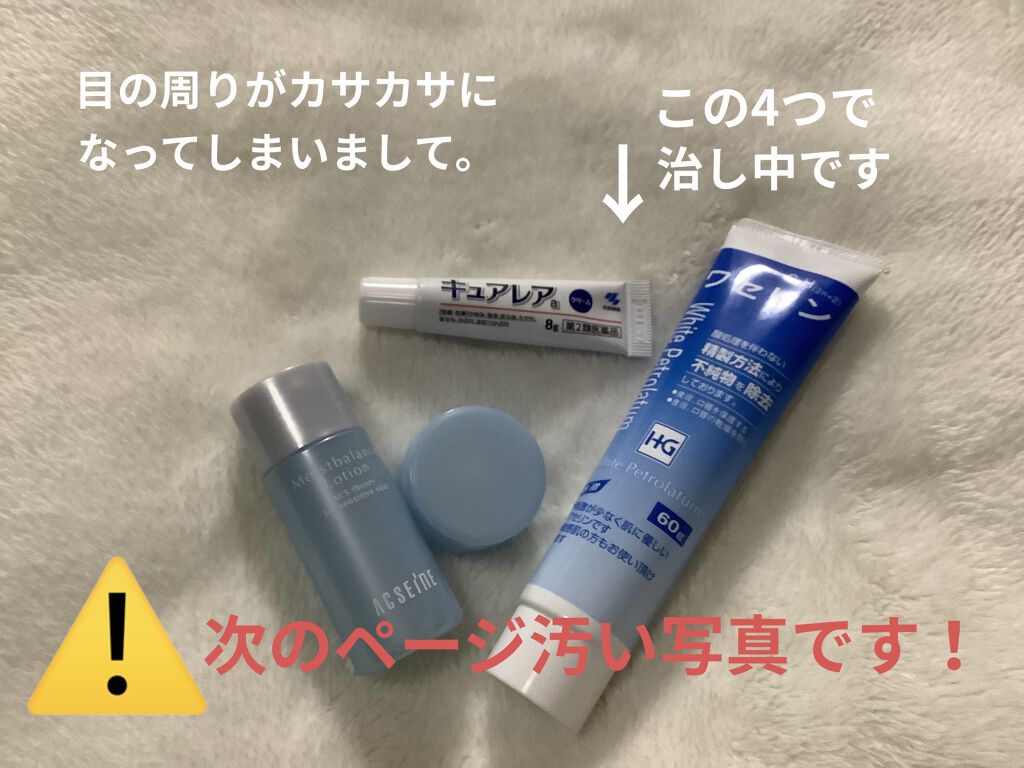 キュアレア（医薬品）/キュアレアa/その他を使ったクチコミ（1枚目）