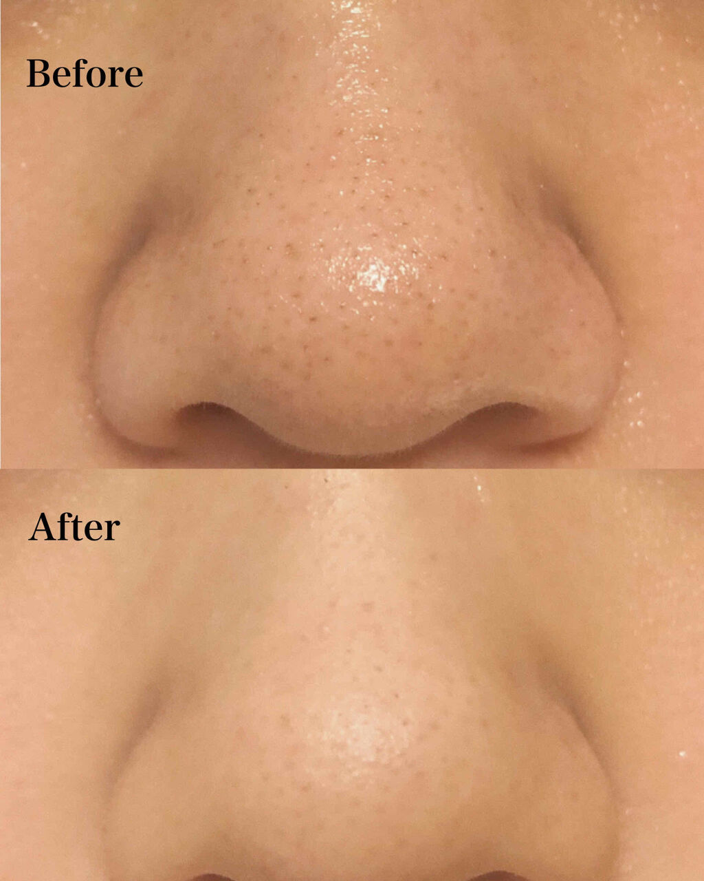 オリジナル ピュアスキンジェリー/ヴァセリン/ボディクリームを使ったクチコミ（2枚目）