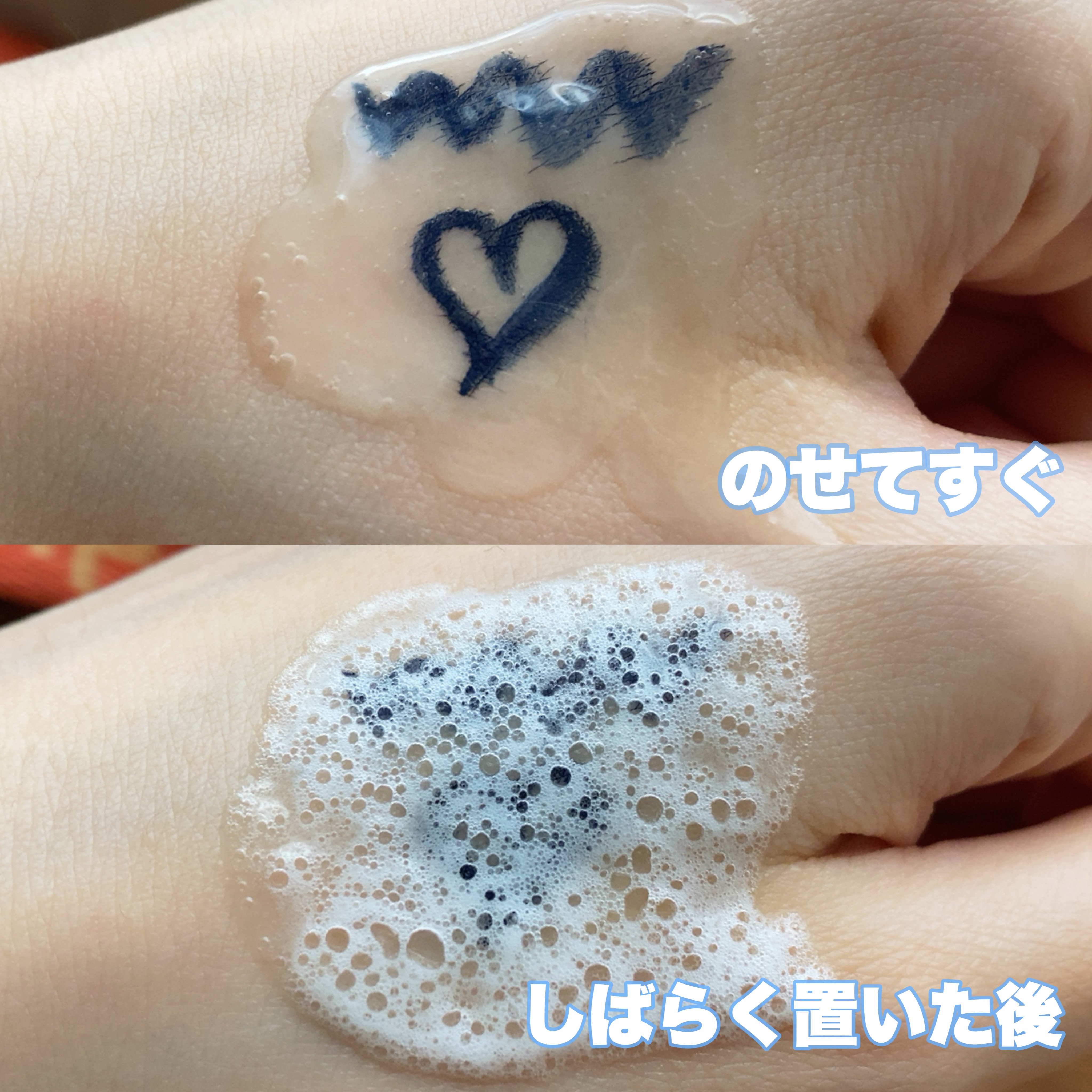 マイクロバブルジェルクレンジング/Macchia Label/クレンジングジェルを使ったクチコミ（2枚目）