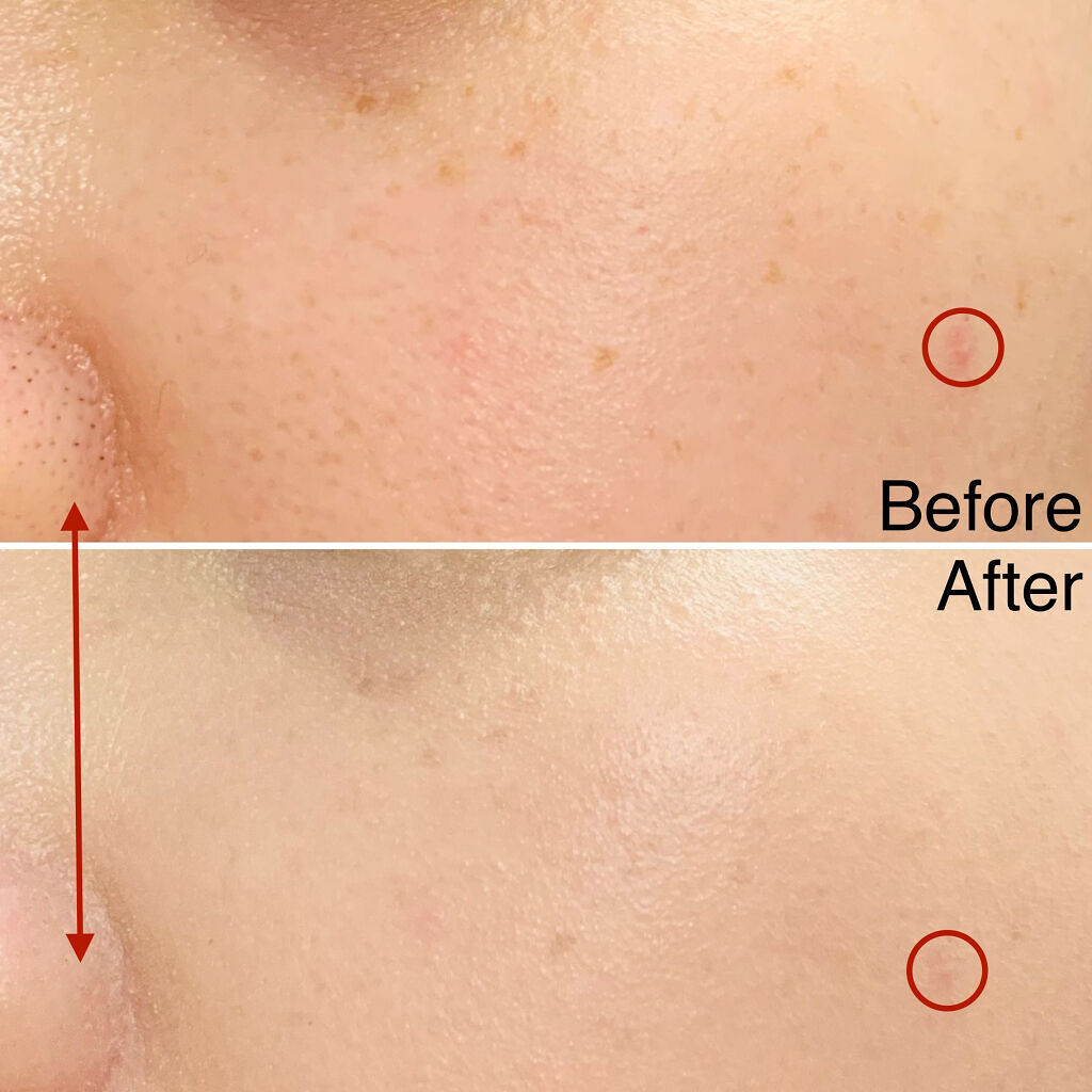 ネオクッション マット/LANEIGE/クッションファンデーションを使ったクチコミ（2枚目）