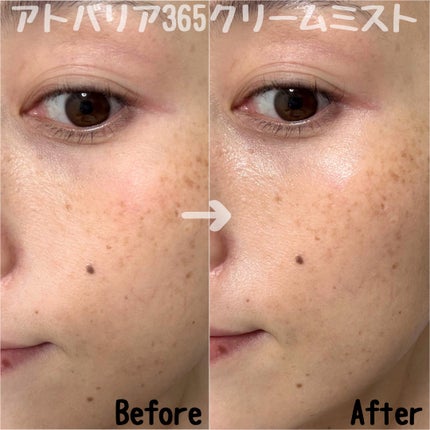 アトバリア365クリーム/AESTURA/フェイスクリームを使ったクチコミ(4枚目)
