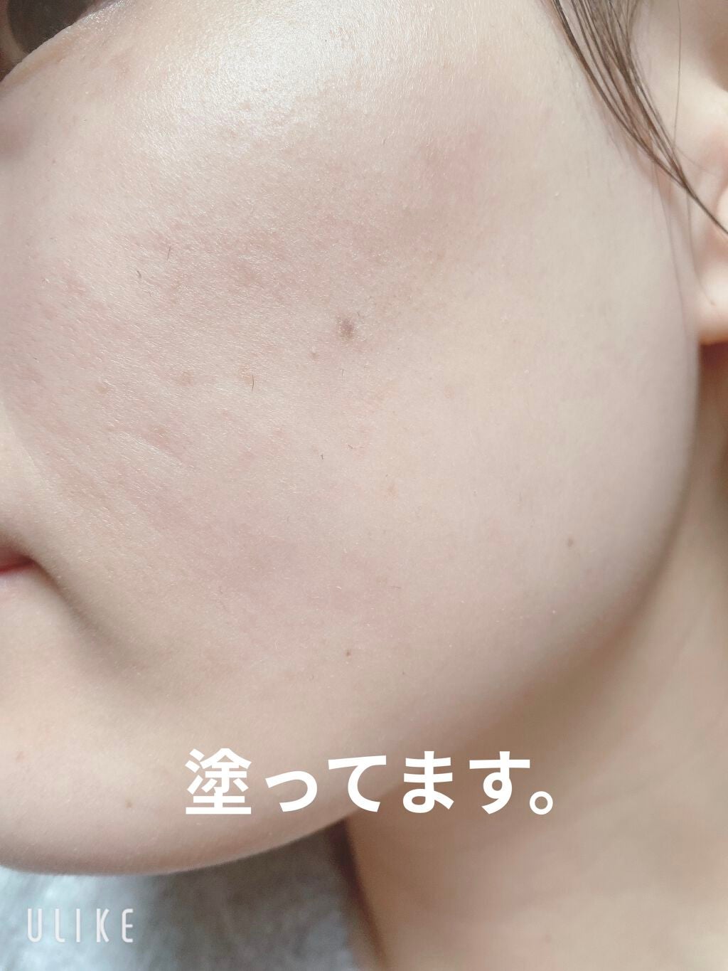 ドクタージャルト シカペア リカバー (第2世代)/Dr.Jart+/フェイスクリームを使ったクチコミ(5枚目)