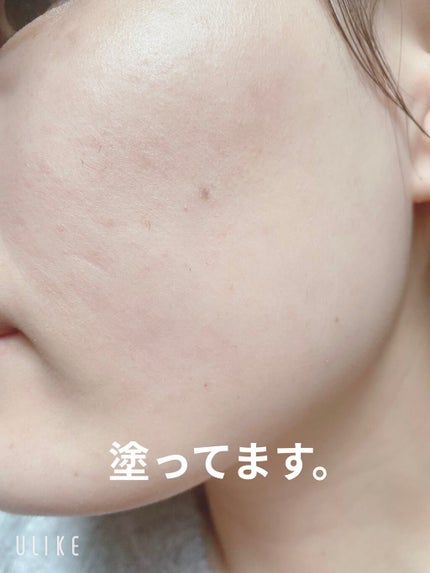 ドクタージャルト シカペア リカバー (第2世代)/Dr.Jart+/フェイスクリームを使ったクチコミ(5枚目)