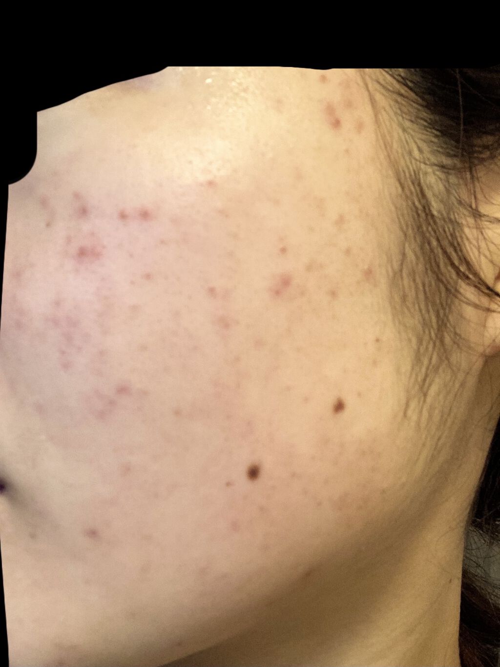 ハトムギ化粧水(ナチュリエ スキンコンディショナー R )/ナチュリエ/化粧水を使ったクチコミ（3枚目）