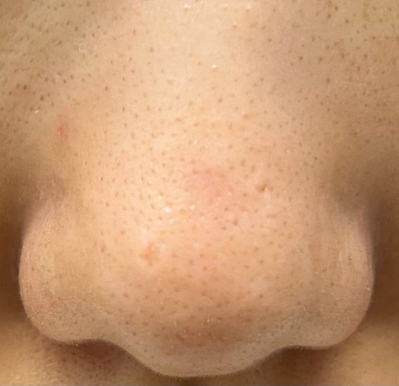 ムースネトワイアントCn/クレ・ド・ポー ボーテ/洗顔フォームを使ったクチコミ(6枚目)