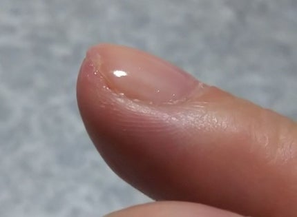 ボリュームジェルトップコート/ネイルネイル/ネイルトップコートを使ったクチコミ(1枚目)