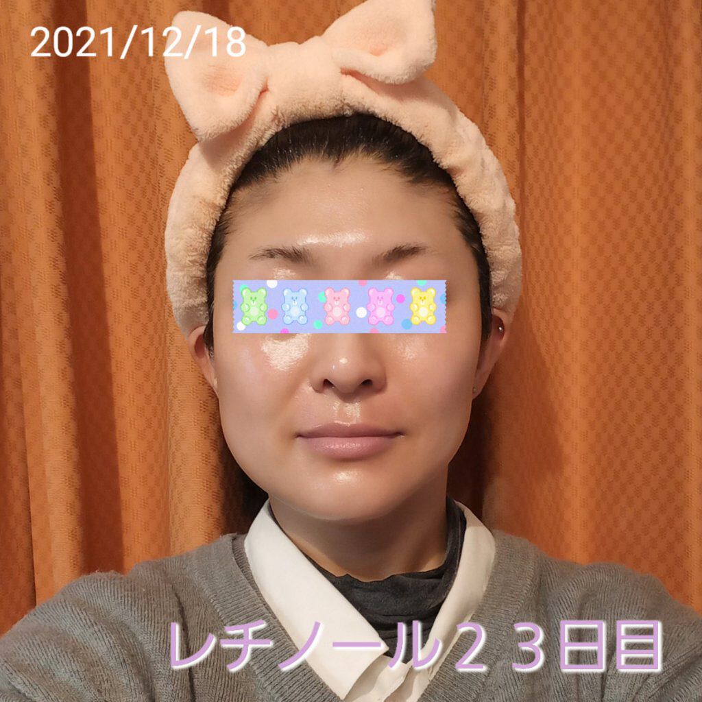 スーパーリンクルセラムVA/KISO/美容液を使ったクチコミ（1枚目）