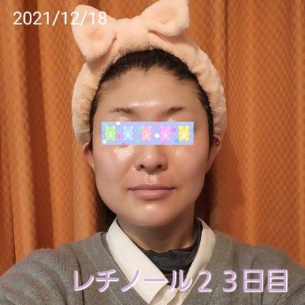 スーパーリンクルセラムVA/KISO/美容液を使ったクチコミ(1枚目)