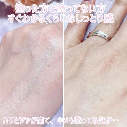 ピンクティーツリートナー/APLIN/化粧水を使ったクチコミ(3枚目)