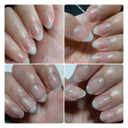 ポニキウムオイル/enieni /ネイルオイル・トリートメントを使ったクチコミ(4枚目)