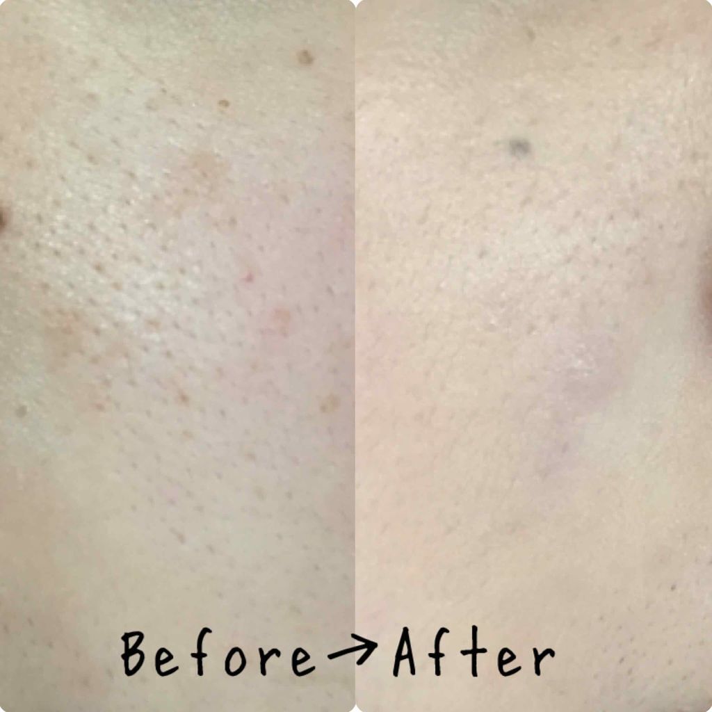 水ジェリークラッシュ/インテグレート/クリーム・エマルジョンファンデーションを使ったクチコミ(2枚目)