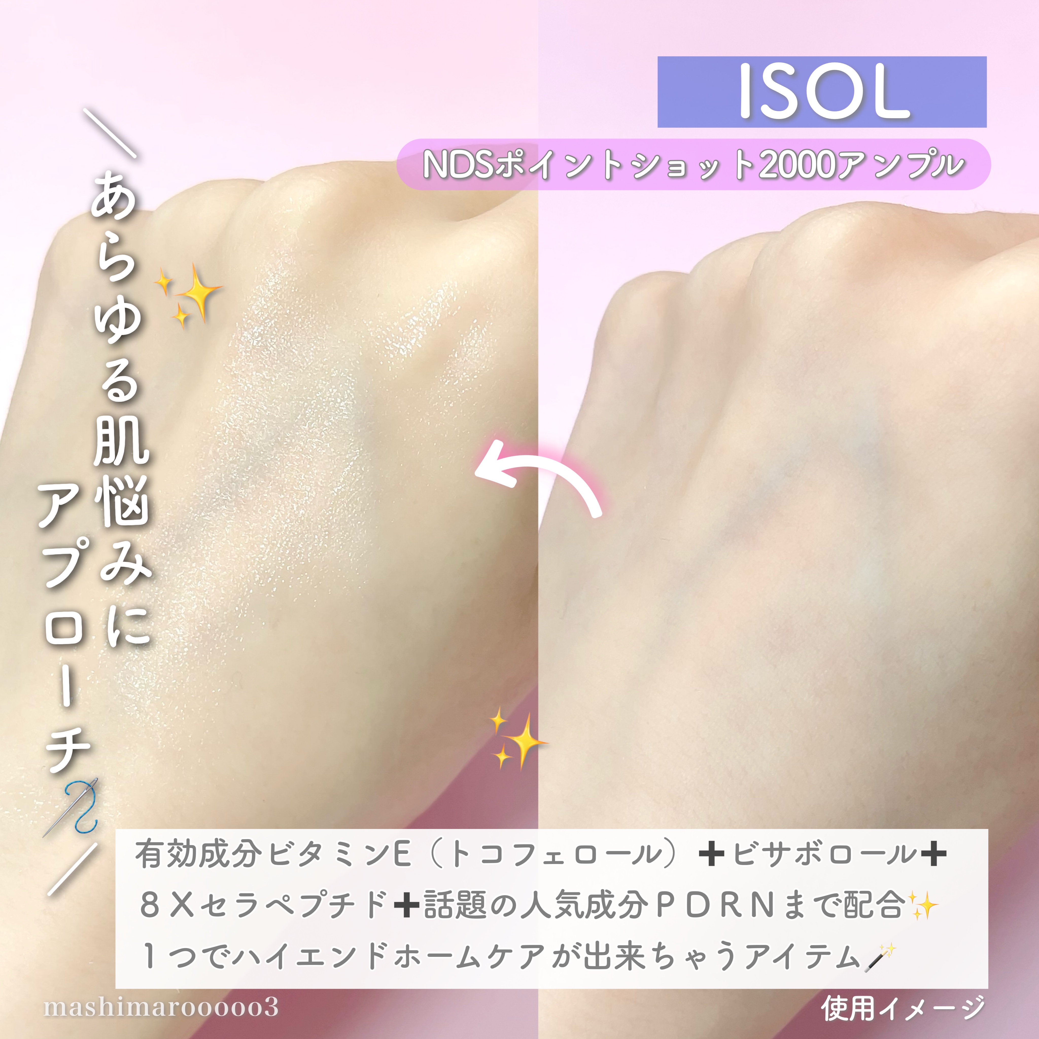 NDSポイントショット2000アンプル/ISOI/美容液を使ったクチコミ（3枚目）