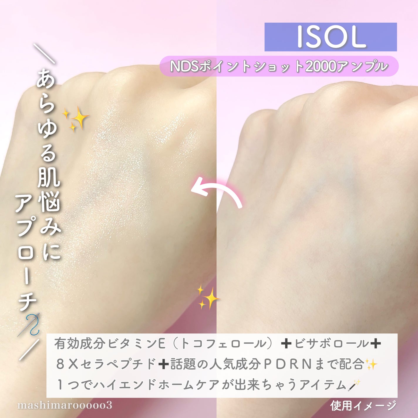 NDSポイントショット2000アンプル/ISOI/美容液を使ったクチコミ(3枚目)
