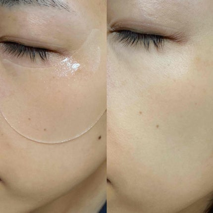 グルタチオンダークゼロトーニングパッチ/SNP/アイケア・アイクリームを使ったクチコミ(5枚目)