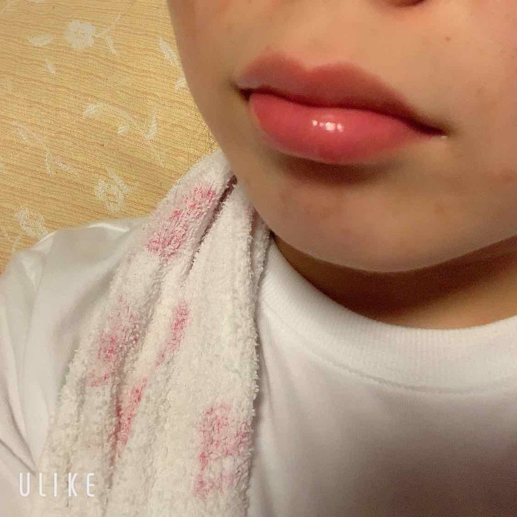 38°C / 99°F リップトリートメント (リップ美容液)/UZU BY FLOWFUSHI/リップケアを使ったクチコミ（3枚目）