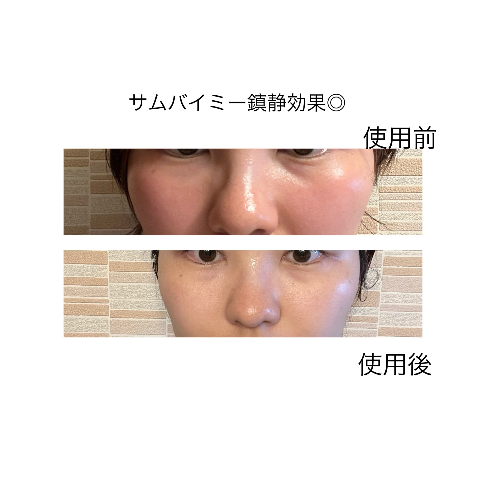 ベタ-パンテノールクリーム/SOME BY MI/フェイスクリームを使ったクチコミ（1枚目）