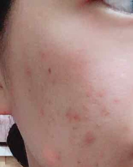 ハトムギ化粧水(ナチュリエ スキンコンディショナー R )/ナチュリエ/化粧水を使ったクチコミ(2枚目)