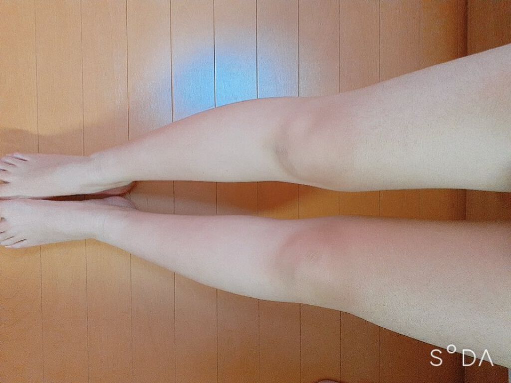 寝ながらメディキュット スパッツ 骨盤テーピング/メディキュット/着圧ソックス・レギンスを使ったクチコミ（2枚目）