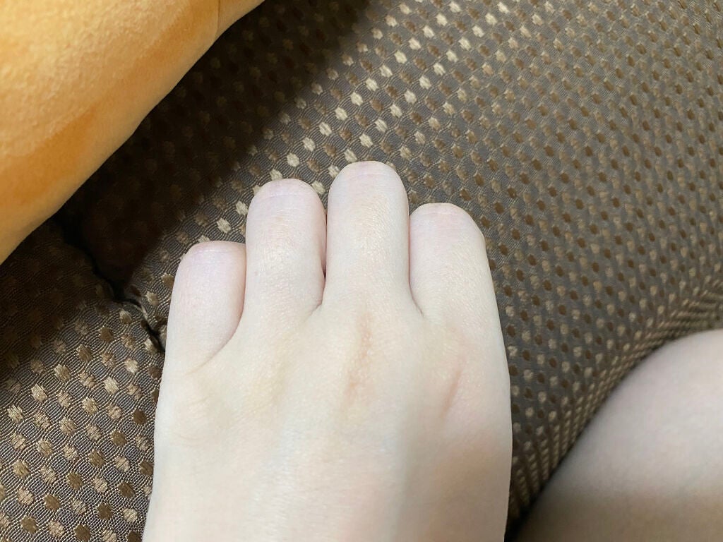 アイスレディ/icelady/家庭用脱毛器を使ったクチコミ(6枚目)