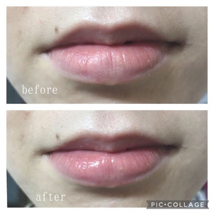 38°C / 99°F リップトリートメント (リップ美容液)/UZU BY FLOWFUSHI/リップケアを使ったクチコミ(4枚目)