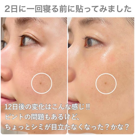 ディープビタCパッチ/MEDICUBE/その他スキンケアを使ったクチコミ(4枚目)