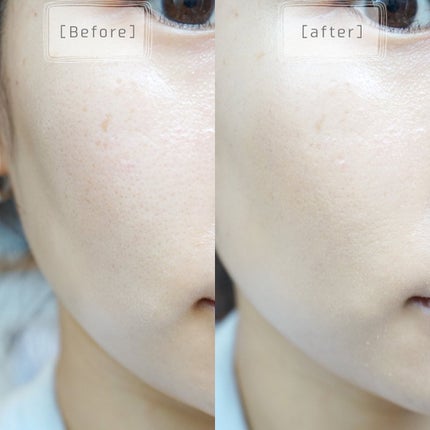 ピンクティーツリーカバーアップグロウクッション/APLIN/クッションファンデーションを使ったクチコミ(2枚目)