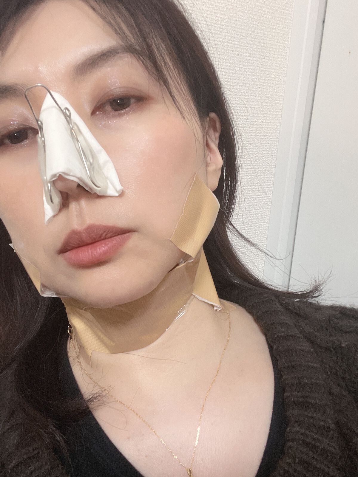 AHA 30% + BHA 2% Peeling Solution/The Ordinary/ピーリングを使ったクチコミ(1枚目)