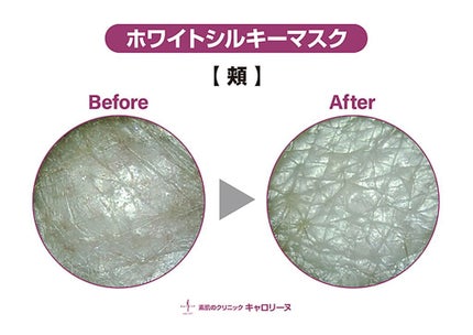 ホワイトシルキーマスク/キャロリーヌ/洗い流すパック・マスクを使ったクチコミ(4枚目)