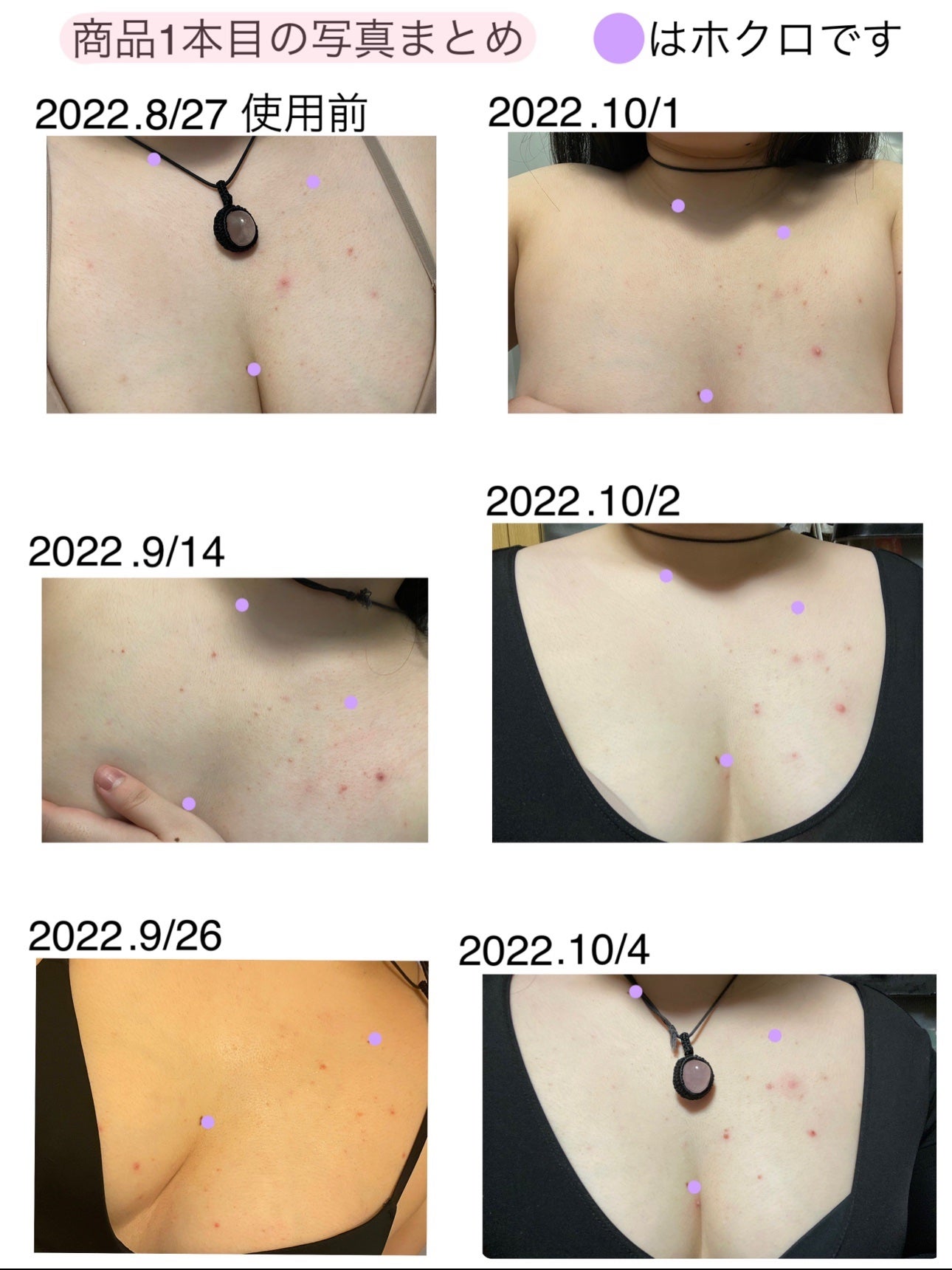 セナキュア(医薬品)/小林製薬/その他を使ったクチコミ(2枚目)