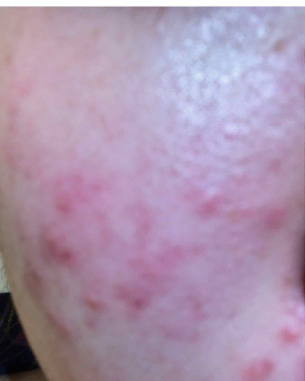 ハトムギ化粧水(ナチュリエ スキンコンディショナー R )/ナチュリエ/化粧水を使ったクチコミ（3枚目）