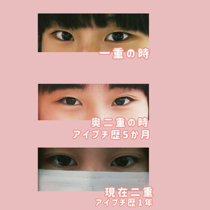 アイビューティー フィクサー WP/アストレア ヴィルゴ/二重まぶた用アイテムを使ったクチコミ(2枚目)