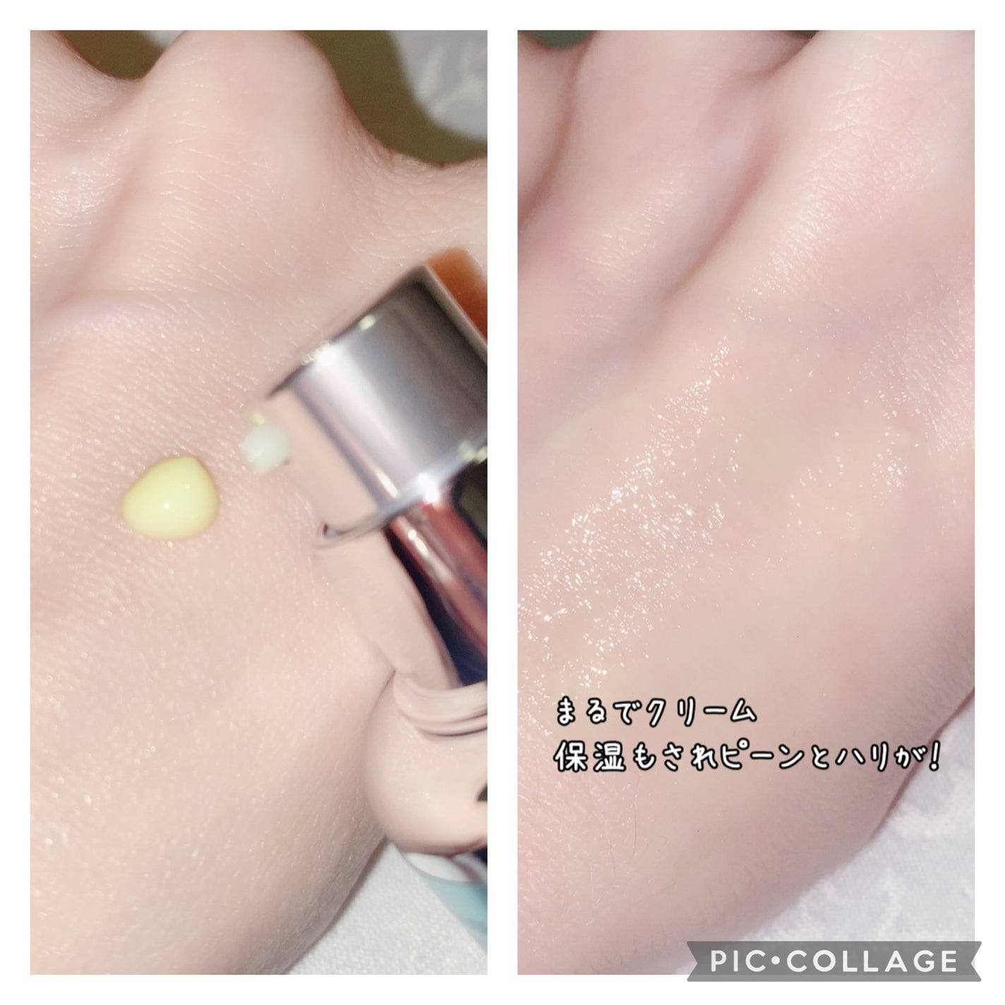 シカレチA エッセンス0.3/VT/美容液を使ったクチコミ(2枚目)