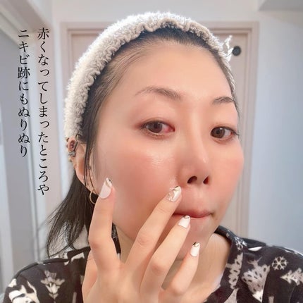 AZ アゼフィットスポッツ/NIKI PITA/フェイスクリームを使ったクチコミ(6枚目)