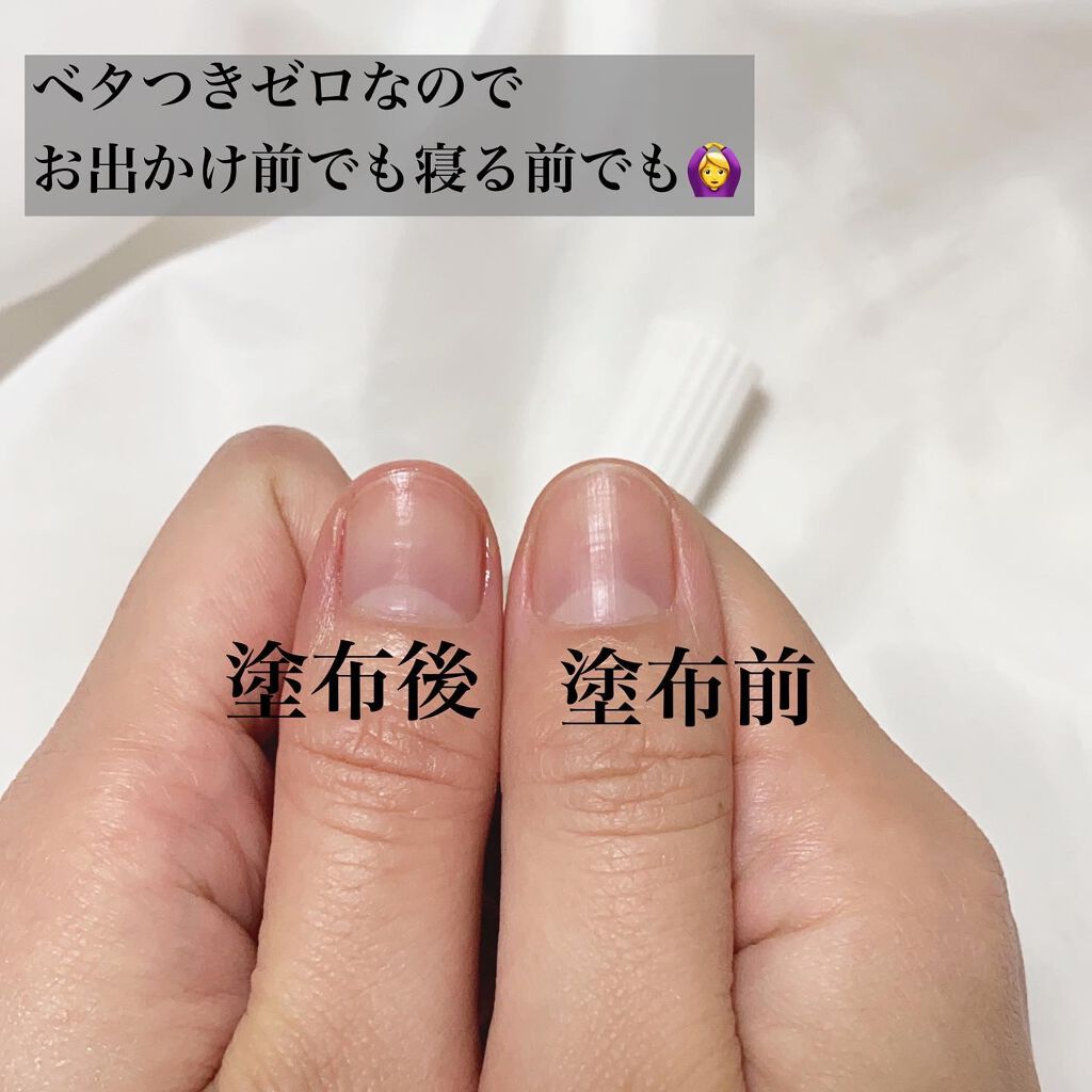 デュアルネイルセラム/シュガードール/ネイルオイル・トリートメントを使ったクチコミ(8枚目)