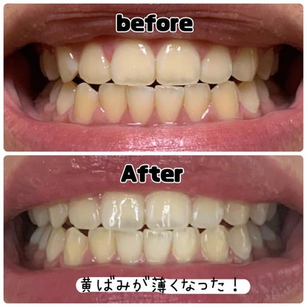 ホワイトニングパウダー シトラスL(レモン&ライム)/Dr.Oral/歯磨き粉を使ったクチコミ(3枚目)