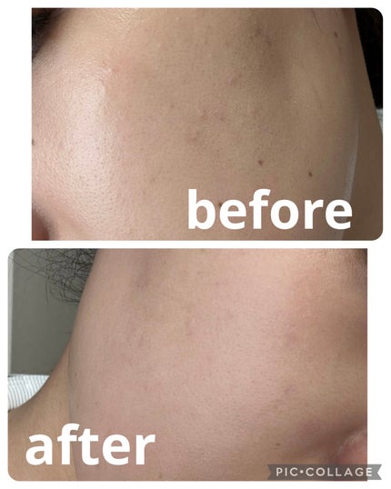 プリズム・リーブル/GIVENCHY/ルースパウダーを使ったクチコミ(5枚目)